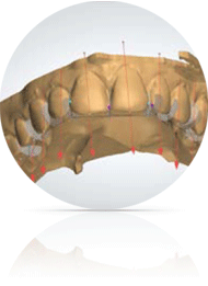 HappySmile invisible orthodontics treatment, 3d modeling